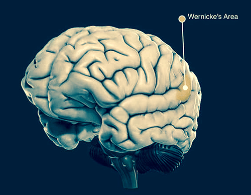 Wernicke's Area for Fluent Aphasia